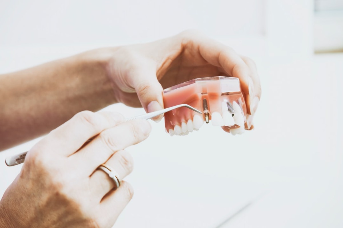 Titelbild zu „Vorteile von Zahnersatz mit CEREC“